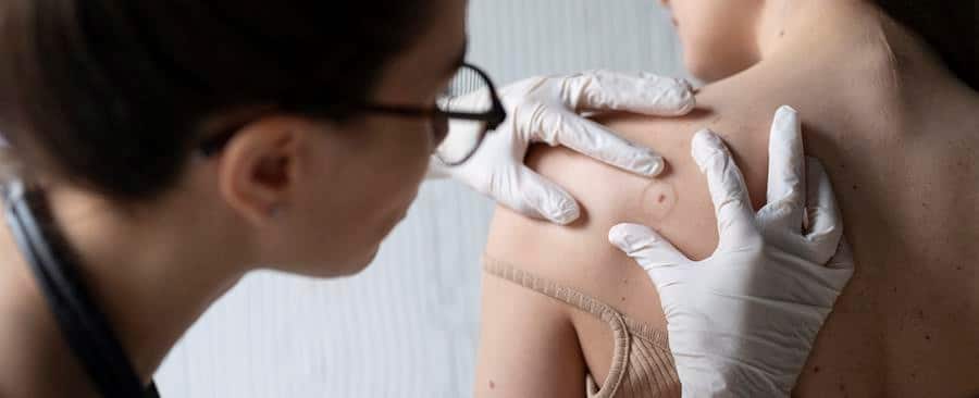 diagnostique et dépistage des cancers cutanés